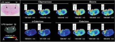 MS-based glycomics: An analytical tool to assess nervous system diseases